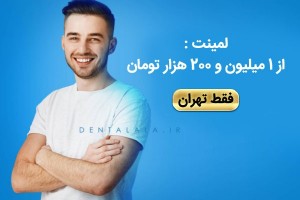 لمینت دندان در مجهزترین کلینیک دندانپزشکی  با بهترین قیمت